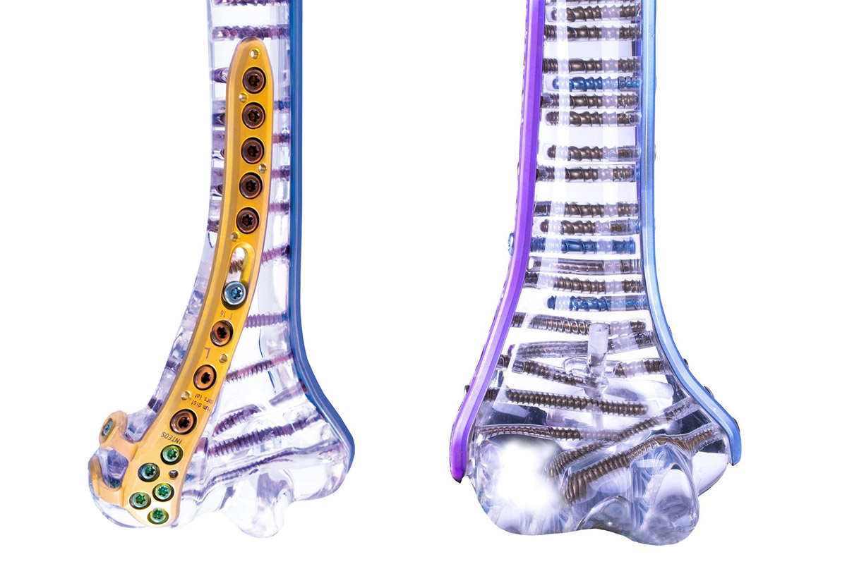 Absolute Orthopaedics